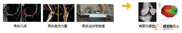 膝關(guān)節(jié)有限元模型輸出